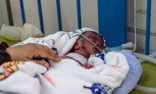Baby Yusra lies in a hospital bed connected to machines and tubes